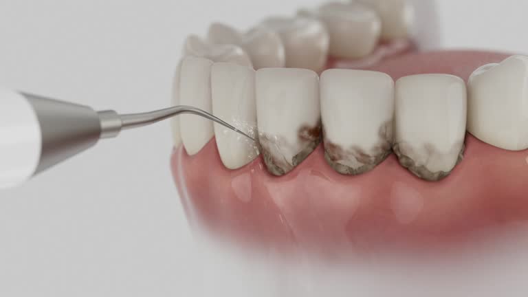 Reliable Dental contractor in Dunlap, IA by Smile Center Dentistry